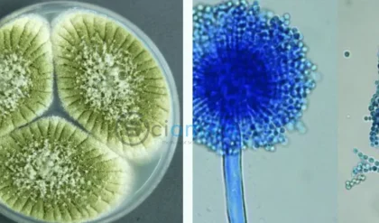 Transforming Cursed Tomb Fungus into Cancer Treatment: The Promising Potential of Aspergillus Flavus 3