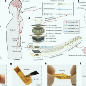 USC Develops Innovative AI Implant for Drug-Free Chronic Pain Relief 16