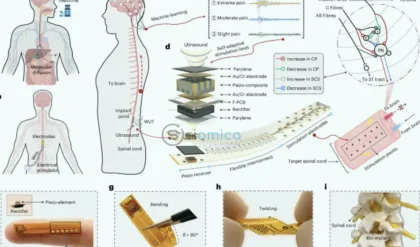 USC Develops Innovative AI Implant for Drug-Free Chronic Pain Relief 5