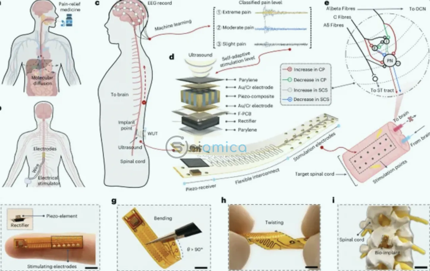 USC Develops Innovative AI Implant for Drug-Free Chronic Pain Relief 1