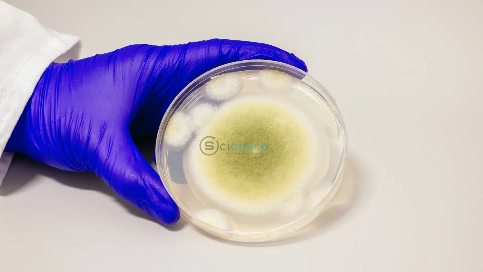 Transforming Cursed Tomb Fungus into Cancer Treatment: The Promising Potential of Aspergillus Flavus 3