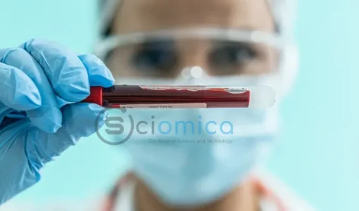 Newly Discovered Blood Group: The Rarest in the World Identified by Scientists 51