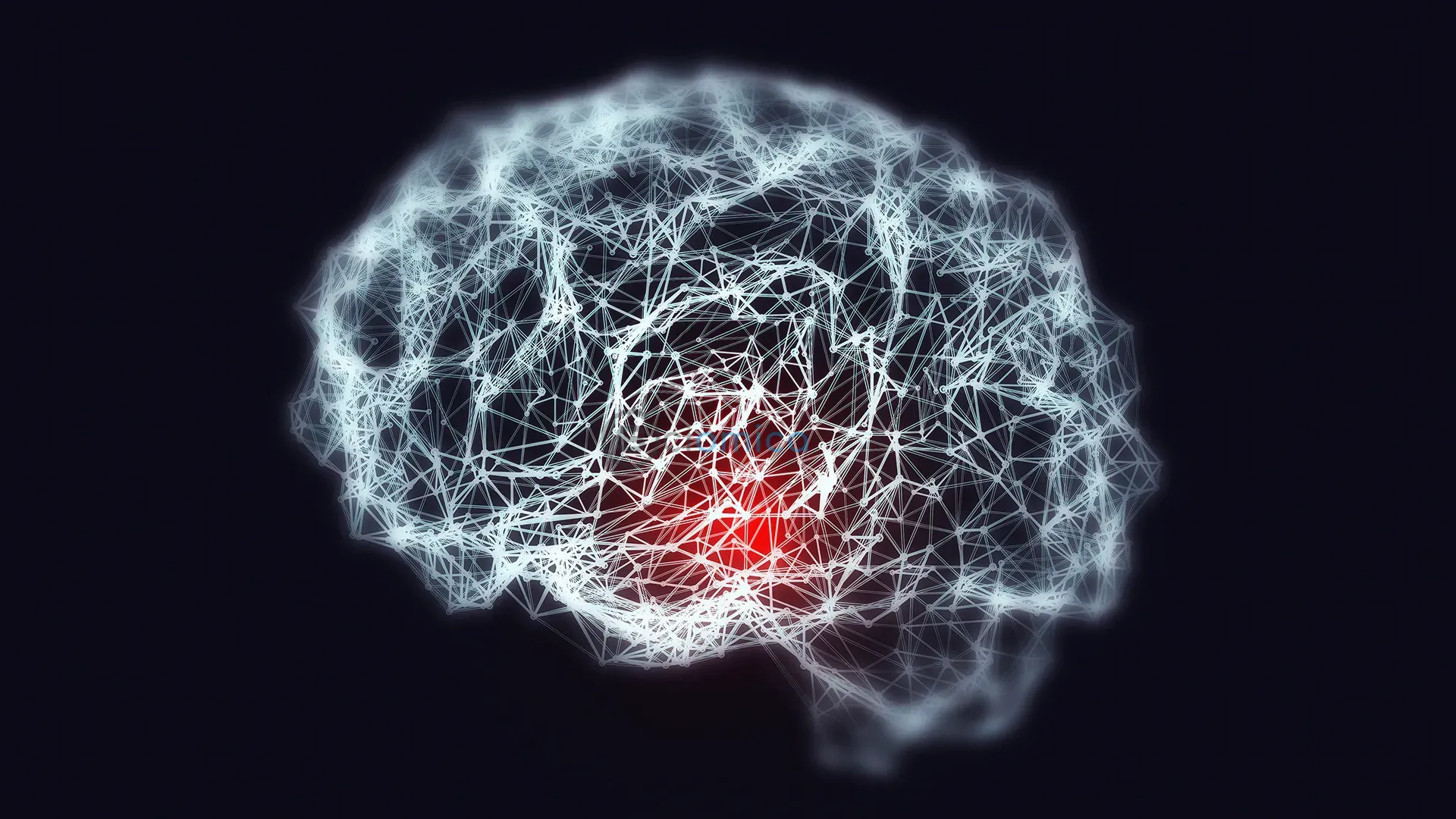 Iron Overload and its Connection to Early Alzheimer's in Individuals with Down Syndrome 1
