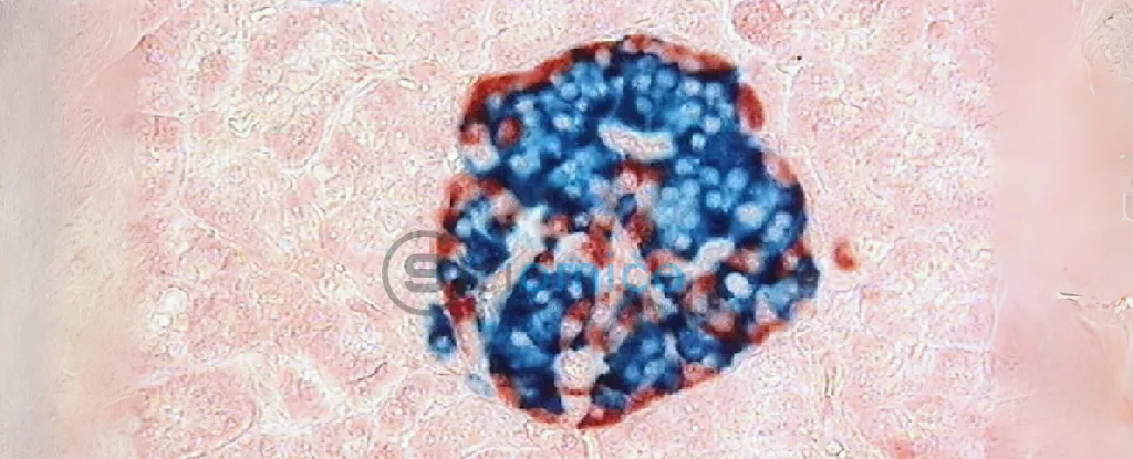 Breakthrough Study Reveals Potential Cure for Severe Type 1 Diabetes 3
